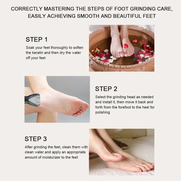 Electric Foot File Grinder Callus Remover Machine Pedicure Device Foot Care Tools Feet Heels Dead Hard Skin USB for Men Women - Image 6