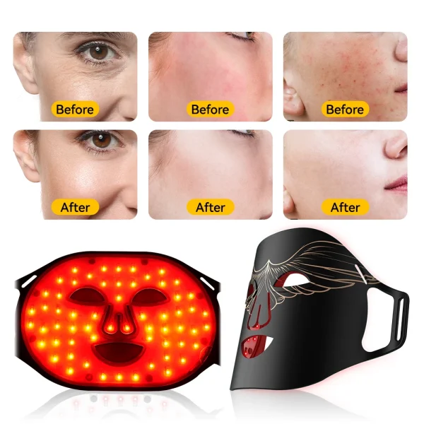 Lescolton New Red Led Light Therapy Infrared Flexible Soft Mask Silicone 4 Color Led Therapy Anti Aging Advanced Photon Mask - Image 4