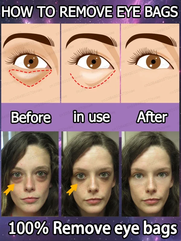 The heavier the eye bags and dark circles, the better the effect - Image 6