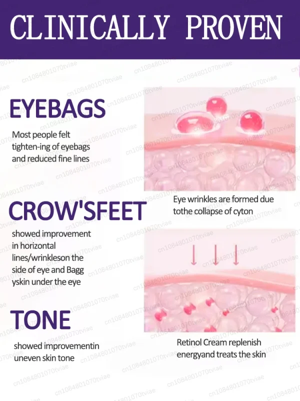 The heavier the eye bags and dark circles, the better the effect - Image 2