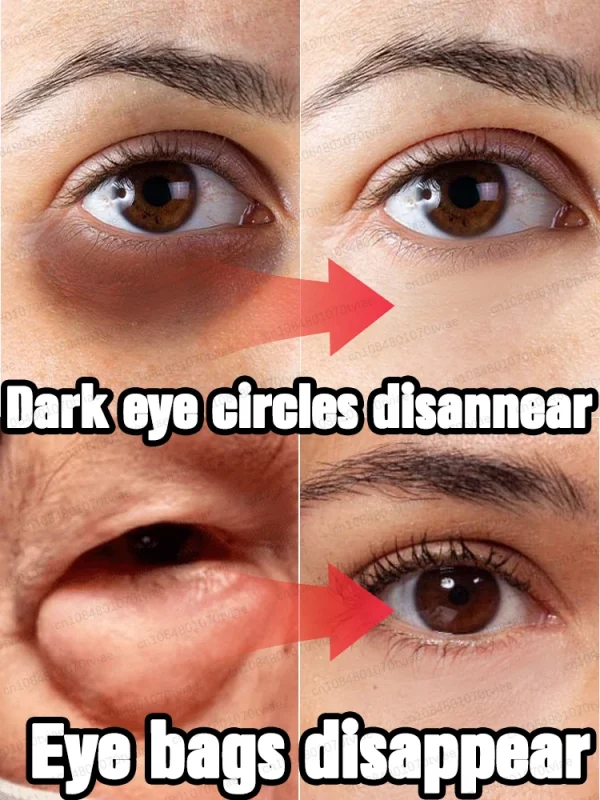 The heavier the eye bags and dark circles, the better the effect - Image 3