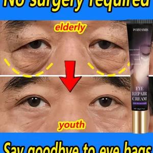 The heavier the eye bags and dark circles, the better the effect